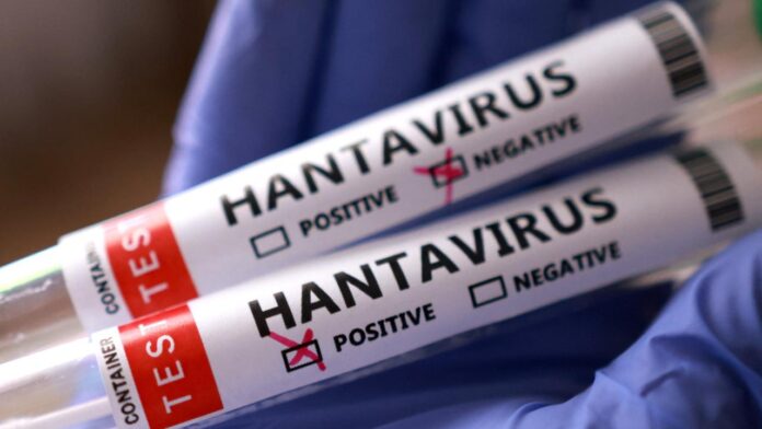 1778334347_hantavirus-reu-2459423.jpg