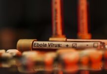 ABD’den Ebola uyarısı: Tarihin en ölümcül seviyesine ulaşabilir