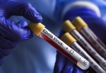 Kenya: ABD bağlantılı Ebola karantina tesisleri için kamuoyunun görüşü alınmayacak