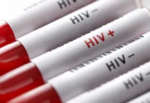 Sağlık Bakanlığı: Sosyal medyadaki HIV paylaşımları gerçeği yansıtmıyor