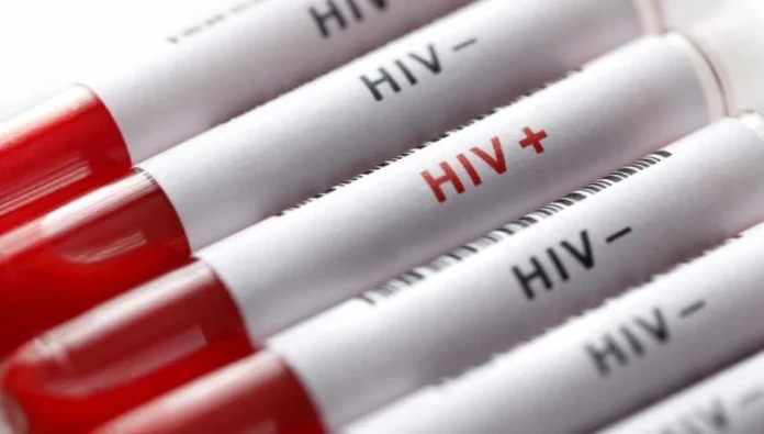 v2hiv_1732687522.webp